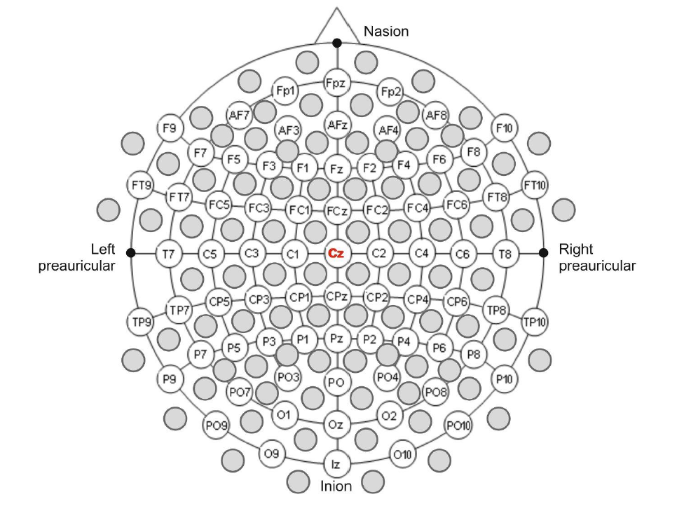 electrode placement